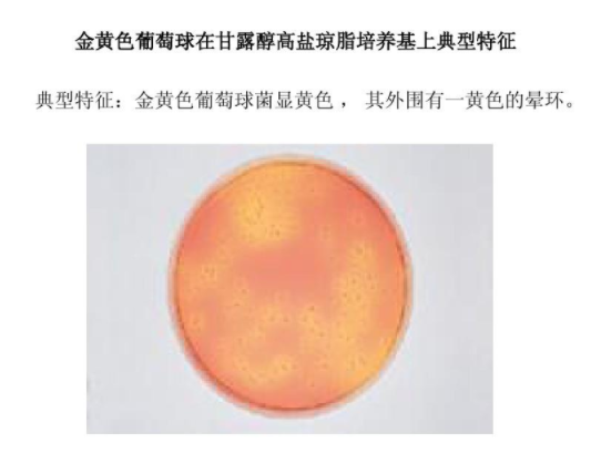 金黄色葡萄球菌培养状? /><span style=