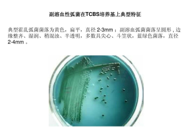 副溶血性弧菌培养状? /><span style=